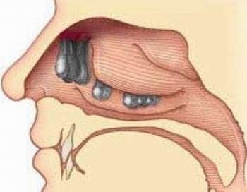 Chảy nước mắt sống,vì sao?