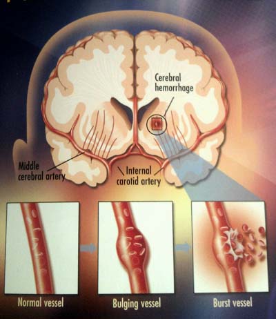 Những biến chứng nguy hiểm ở người bệnh tiểu đường